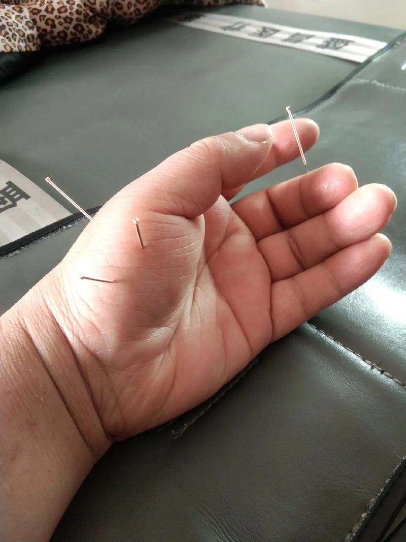 针灸推拿专业学什么
